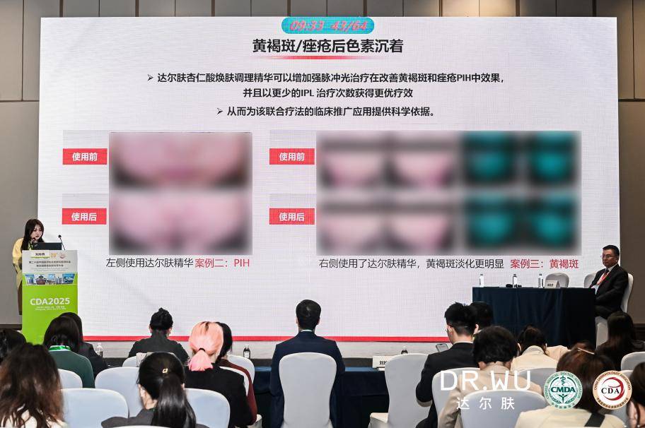 DR.WU達爾膚亮相CDA大會 第三屆痤瘡研究基金正式揭幕